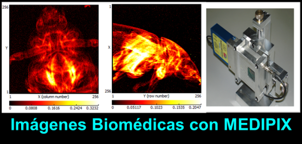 Imágenes Biomédicas 